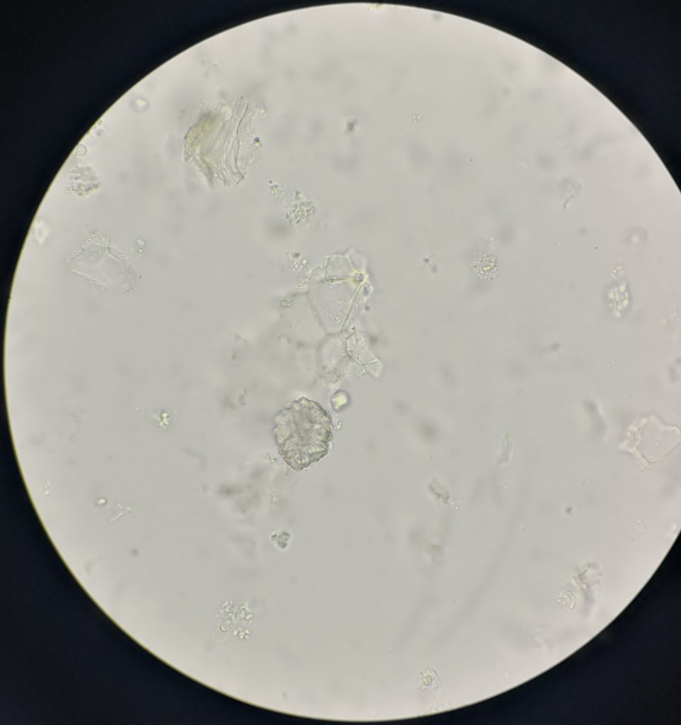 草酸钙针晶显微图图片